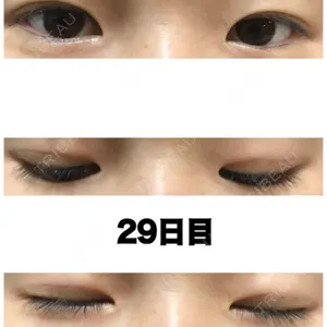 MIYAフェイスクリニック口コミ