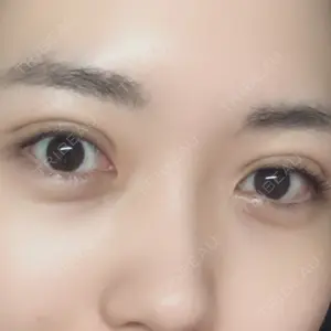 POP美容整形クリニック口コミ