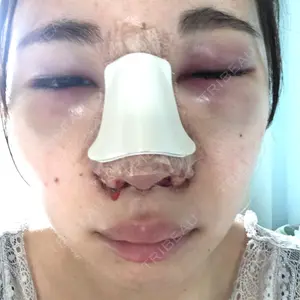 HANABI整形外科口コミ