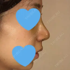 HANABI整形外科口コミ