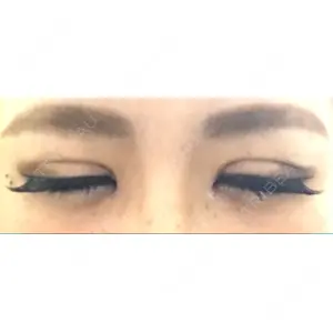 口コミ