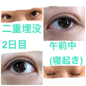 TCB東京中央美容外科 TCB東京中央美容外科 中野院口コミ