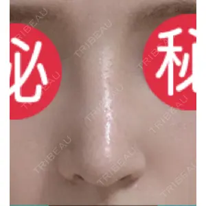 口コミ