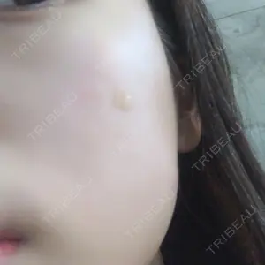 abijouクリニック口コミ