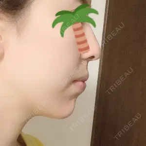 TCB東京中央美容外科 TCB東京中央美容外科 新宿東口院口コミ