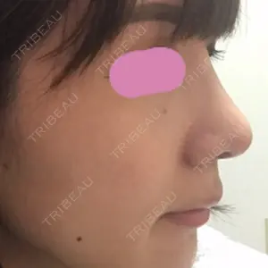 HANABI整形外科口コミ
