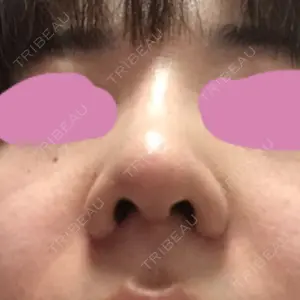 HANABI整形外科口コミ