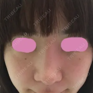 HANABI整形外科口コミ