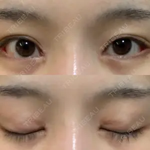 口コミ