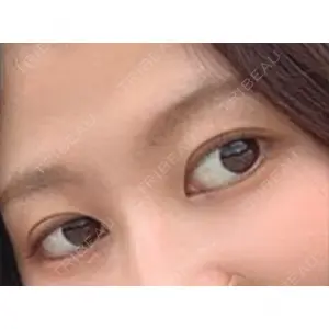 マーブル整形外科口コミ