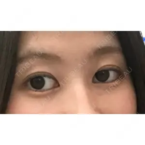 マーブル整形外科口コミ