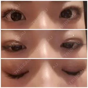 湘南美容クリニック 湘南美容クリニック 新宿本院口コミ