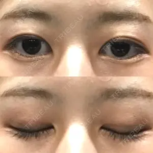 マーブル整形外科口コミ