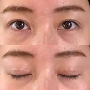 湘南美容クリニック 湘南美容クリニック 熊本院口コミ