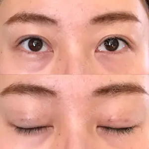 湘南美容クリニック 湘南美容クリニック 熊本院口コミ
