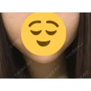 TCB東京中央美容外科 TCB東京中央美容外科 中野院口コミ