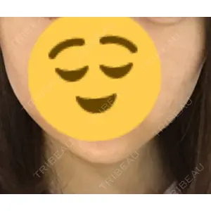 TCB東京中央美容外科 TCB東京中央美容外科 中野院口コミ