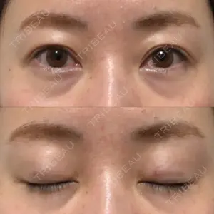 湘南美容クリニック 湘南美容クリニック 熊本院口コミ