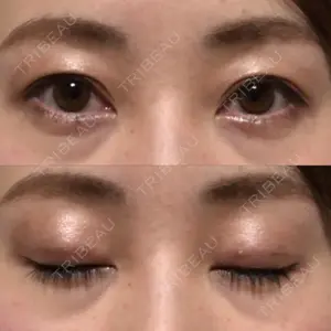 湘南美容クリニック 湘南美容クリニック 熊本院口コミ