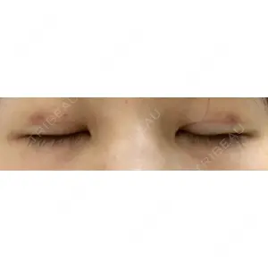 湘南美容クリニック 湘南美容クリニック 京都院口コミ