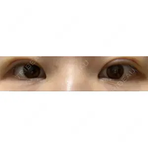 湘南美容クリニック 湘南美容クリニック 京都院口コミ