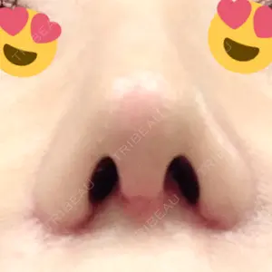 HANABI整形外科口コミ