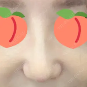 HANABI整形外科口コミ