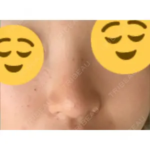 HANABI整形外科口コミ