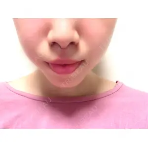 口コミ