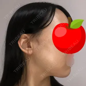 クッキー整形外科の