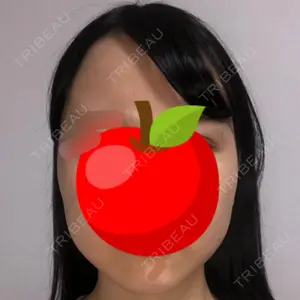 クッキー整形外科の