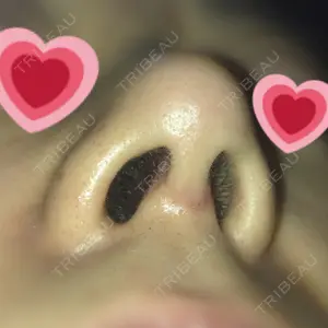 口コミ