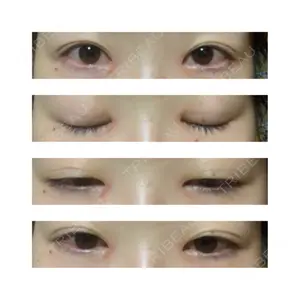 湘南美容クリニック 湘南美容クリニック 新宿本院口コミ