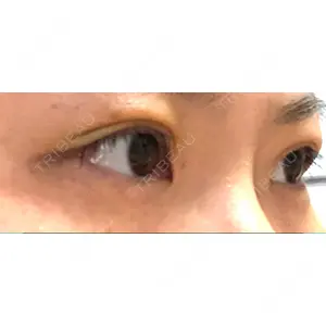 湘南美容クリニック 湘南美容クリニック 京都院口コミ