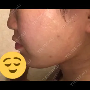 TCB東京中央美容外科 TCB東京中央美容外科 新宿東口院口コミ