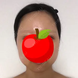 クッキー整形外科の