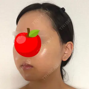 クッキー整形外科の