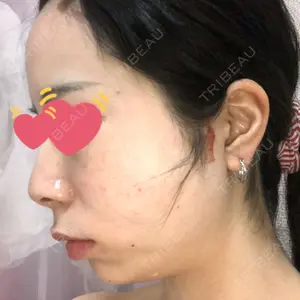 TCB東京中央美容外科 TCB東京中央美容外科 中野院口コミ