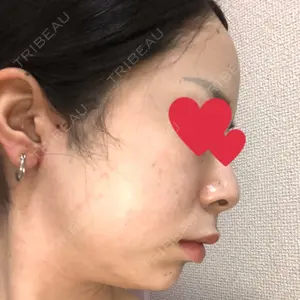 TCB東京中央美容外科 TCB東京中央美容外科 中野院口コミ