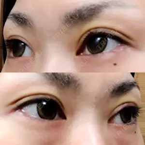 口コミ