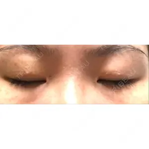 湘南美容クリニック 湘南美容クリニック 京都院口コミ