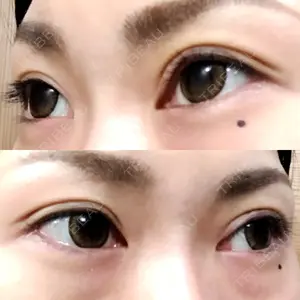 口コミ