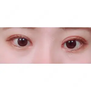 View美容整形外科口コミ