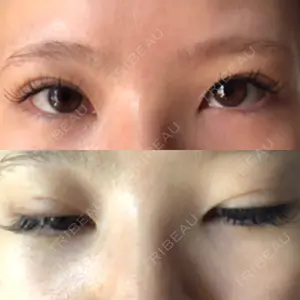 表参道スキンクリニック 表参道スキンクリニック 表参道院口コミ