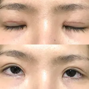 口コミ