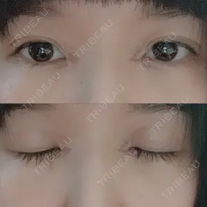 口コミ