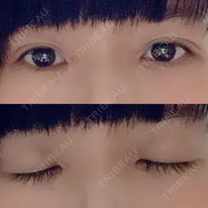口コミ