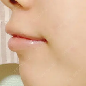 口コミ