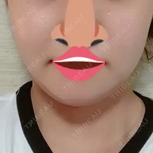 口コミ