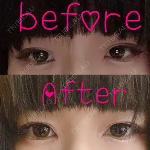 口コミ